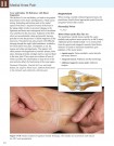 Bok | Sports Medicine Acupuncture • Av Matt Callison, L.Ac. thumbnail
